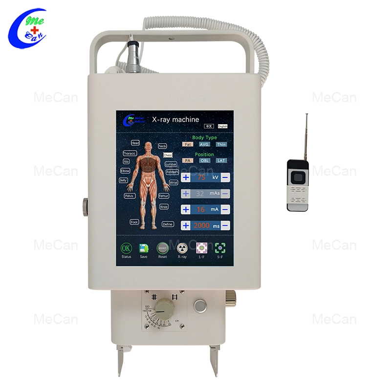 LCD Screen Mobile X Ray Machine 5.6kw Portable X Ray System