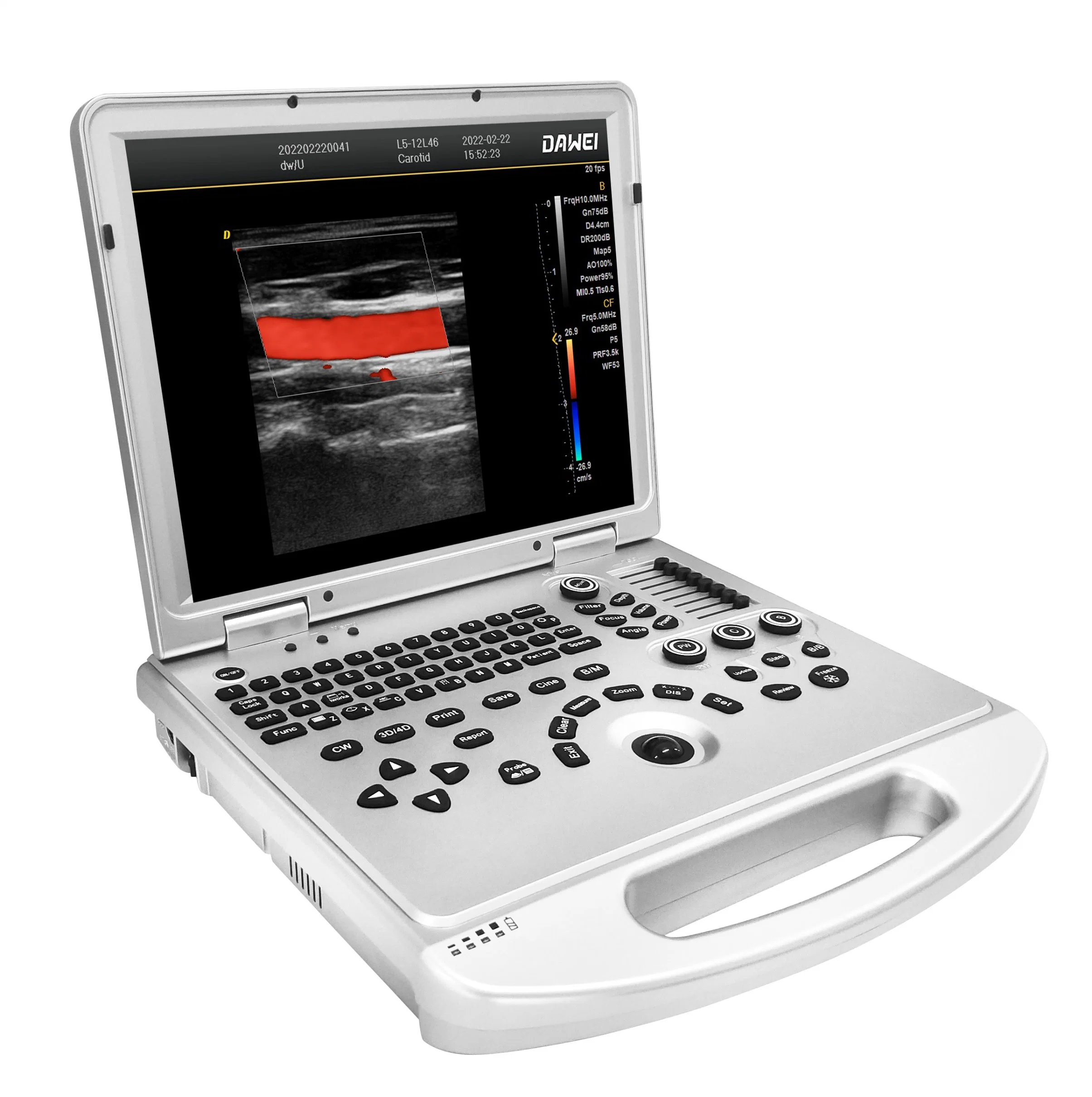 Fashion High quality/High cost performance  Ultrasound Diagnostic Equipment with CE&ISO