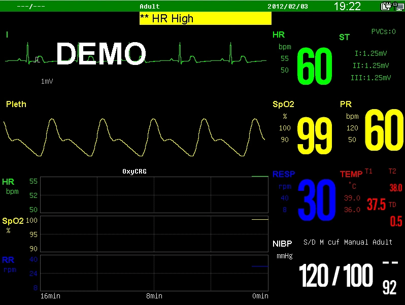 10.4inch Portable Patient Monitor with Suntech NIBP