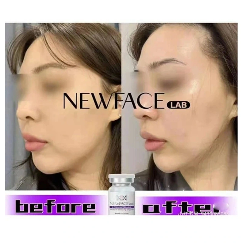 Newface Lab Anti-Wrinkle Whitening Skin Booster Creates a Small V Face with Deep Hydration