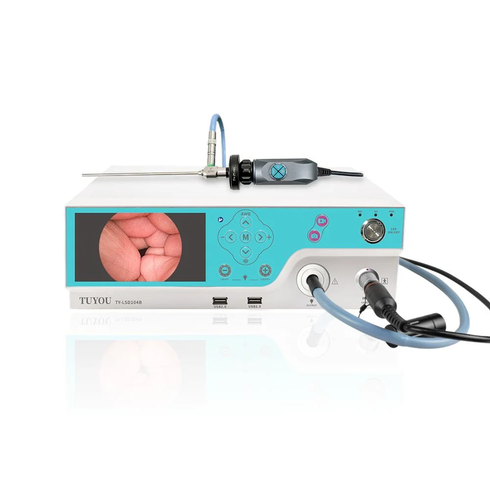 Tuyou New Blue Digestive Endoscopy Medical Equipment Endoscope Camera System for Endoscopie Anale