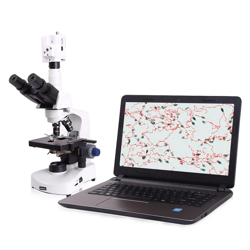 Wsa-10 Portable Microscope de sperme animal vétérinaires automatique de l'analyseur d'analyse de sperme