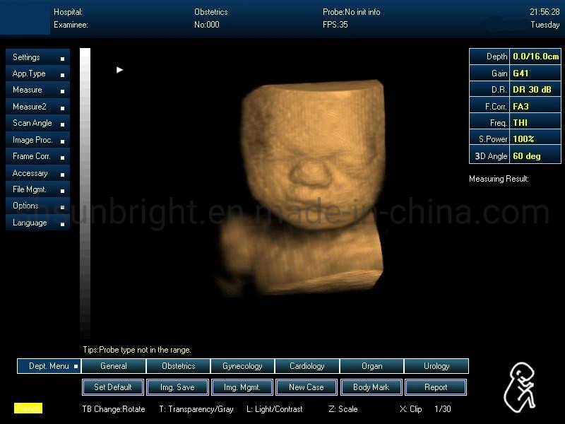 Sunbright Brand Win 7 System Medical 3D Laptop Ultrasound Scanner