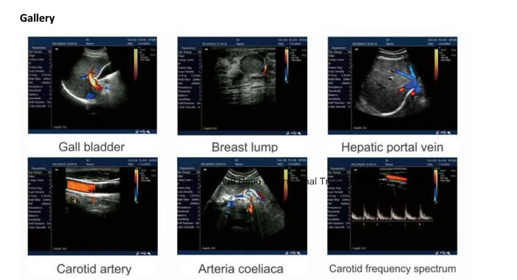 Full Digital Portable Scanner Ultrasound for Vet at Low Price