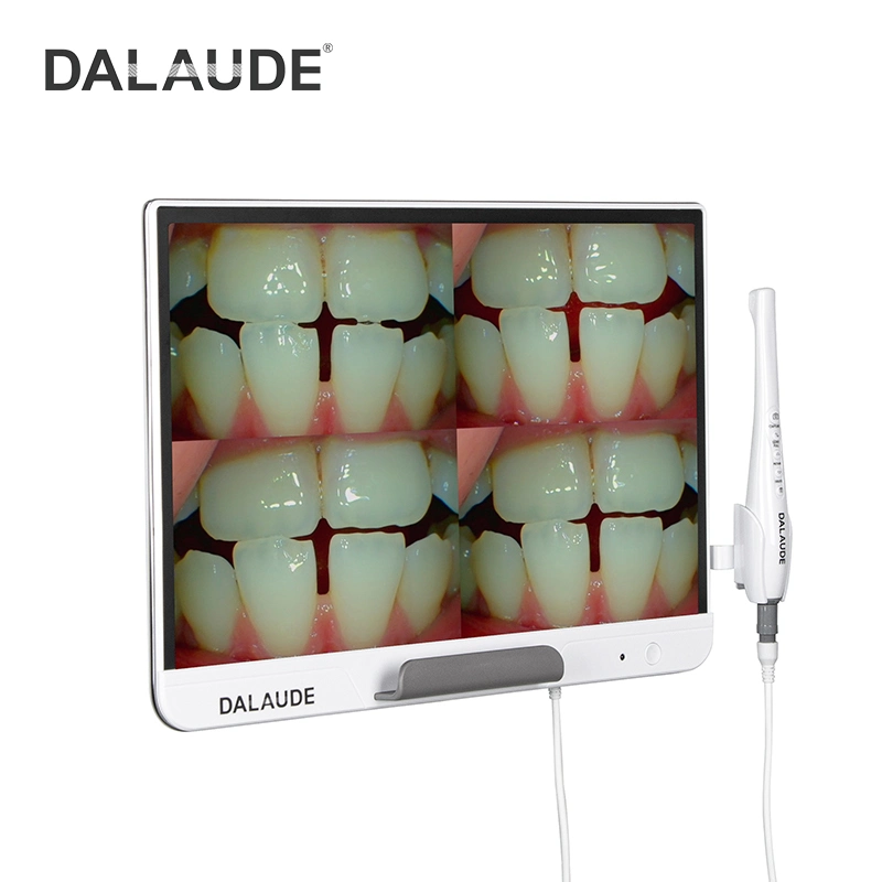 2022 Nice Monitor Intra Oral Camera Images&Video Wireless Transmission in Dentistry