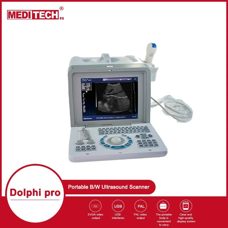 Meditech Laptop Ultrasound Scanner MD2100 with 10 Inch Screen CE ISO Supported