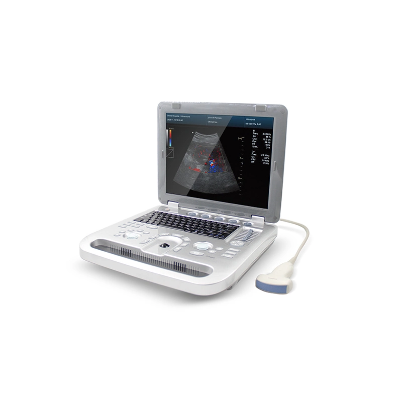 Cms1700b Portable Color Doppler Machine Hospital Ultrasound Scanner