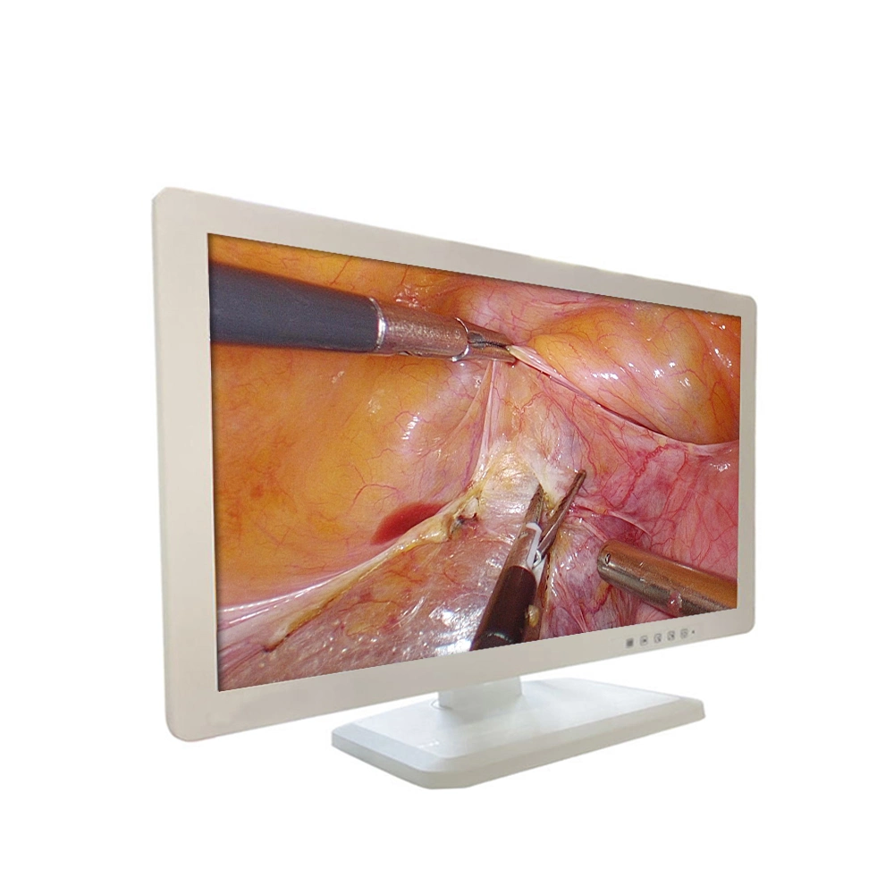 High quality/High cost performance Theater Operation Grade Video Endoscope Monitor with Camera Medical LED Monitors