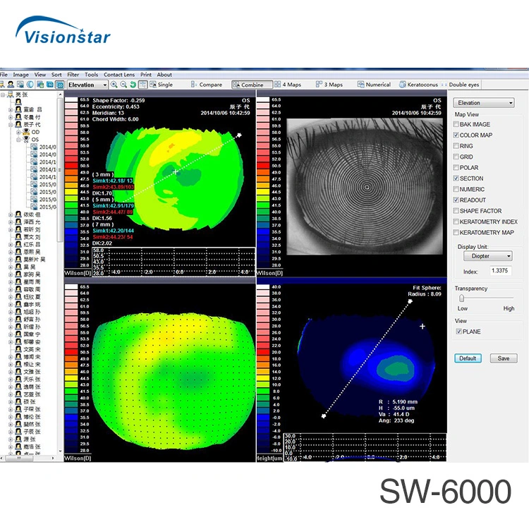 Corneal 3D Map Ophthalmic Corneal Topography Machine