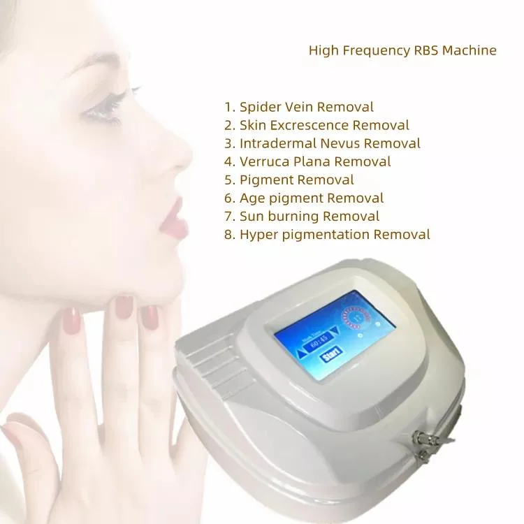 Portable Rbs Spider Vein Removal Machine/Professional Vascular Removal/High Frequency RF Spider Vein Vascular Removal /Vein Finder Removal Facial Machine Rbs