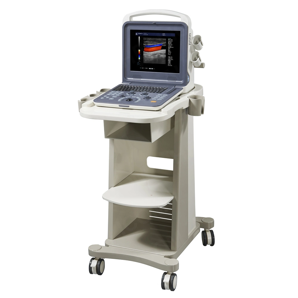 Medical Portable 12 Inch Color Doppler Ultrasound Machine for Pregnancy