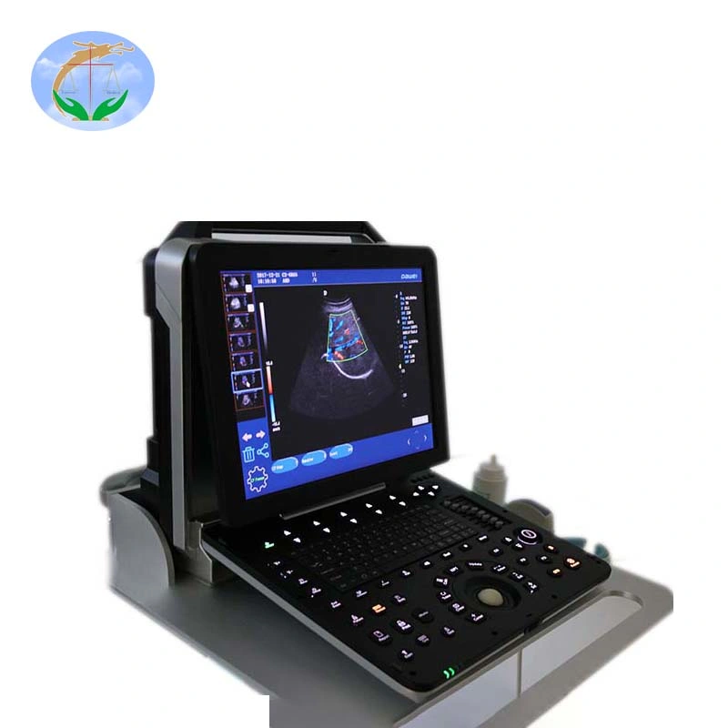 Sistema de diagnóstico por ultrasonido 4D portátil Doppler Color con sonda lineal convexa y