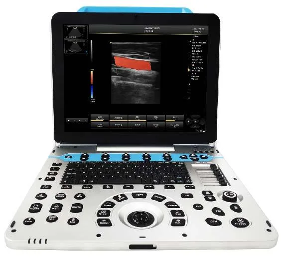 Portable Ultrasound Veterinary Ultrasound Color Doppler Ultrasound System Size 15 Inch Monitor