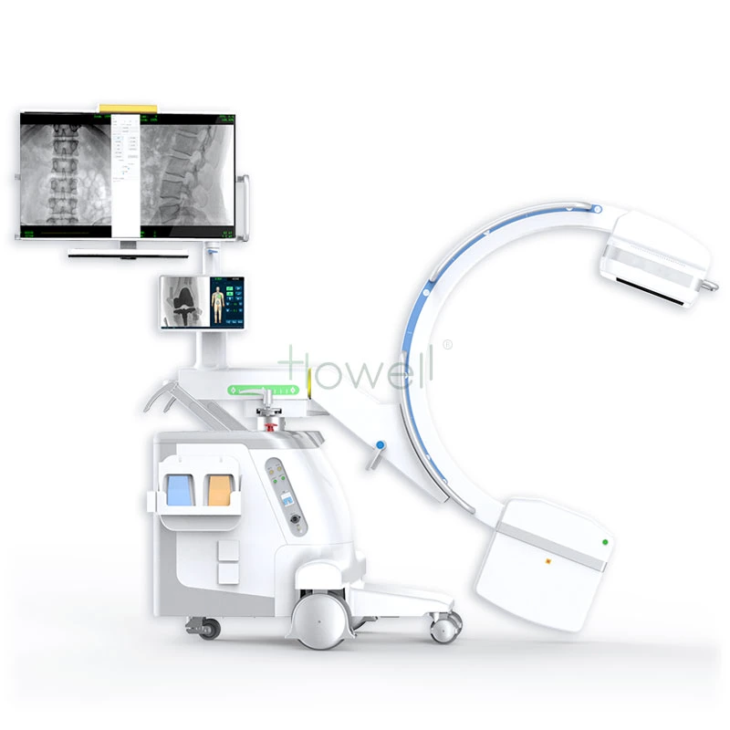 Orthopedic C-Arm Machine Ortho Compact Mobile C-Arm Image System