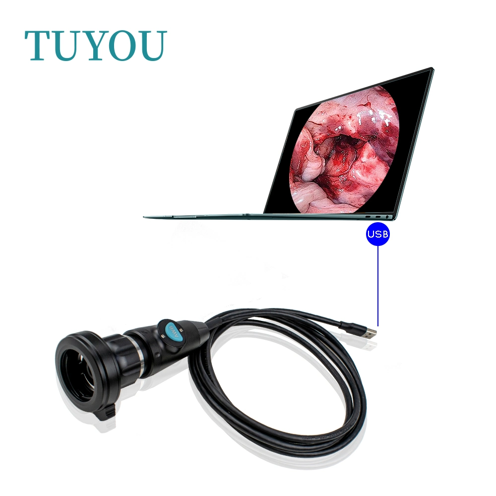 Portable Endoscope USB Type Camera HD Ent Camera Unit