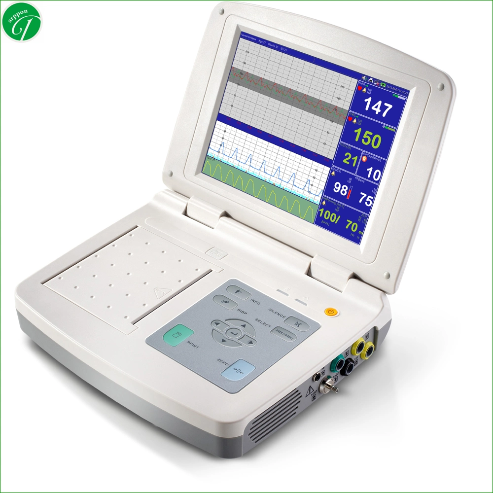 Hospital de 10,4 pulgadas de latido del bebé la supervisión del Monitor Fetal Doppler High-Tech Precio