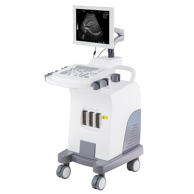 Mecanmed Scanner Hospital Equipment Device Laptop Portable Ultrasound Machine with High Quality