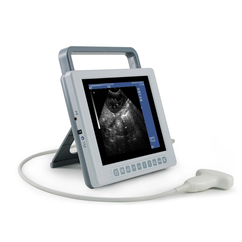 Veterinarian Black and White Super B Scan Ophthalmic Digital Ultrasound Low Price Medicalhigh Intensity Focused Equipment