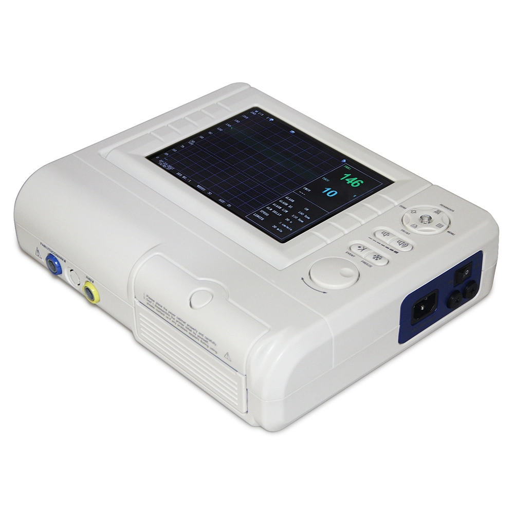 Portable Color Ultrasound Machine Ctg Fetal Monitor