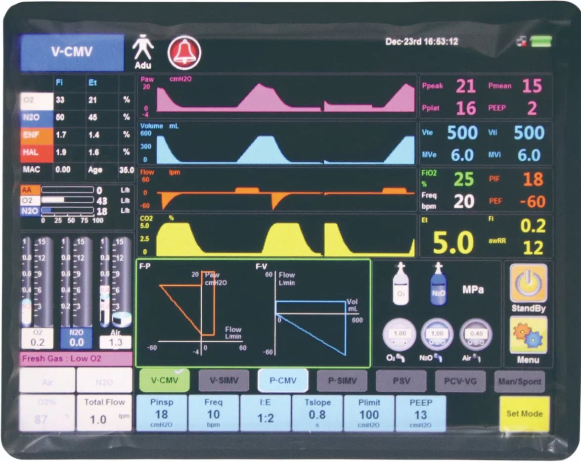 Superstar Med S6600 High End ICU and Operate Room Ventilator Ventilation System