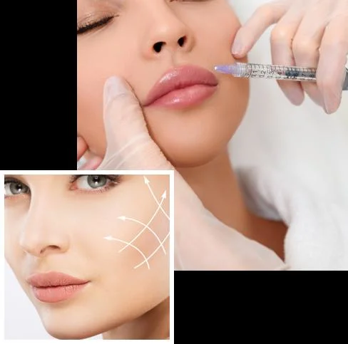 Lang anhaltende Facetem 1,5ml Calcium hydroxyapatit Filler Ca (HA) Dermal Füllstoff Olidia Radiesse