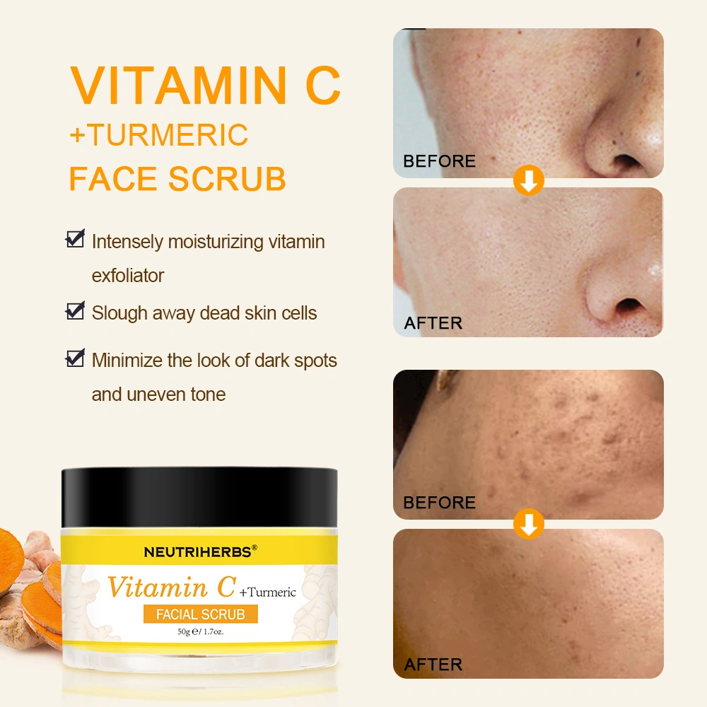 Exfoliación de la OEM Anti-Acne Exfoliator multidimensional de la limpieza de la vitamina C la cúrcuma Face Scrub