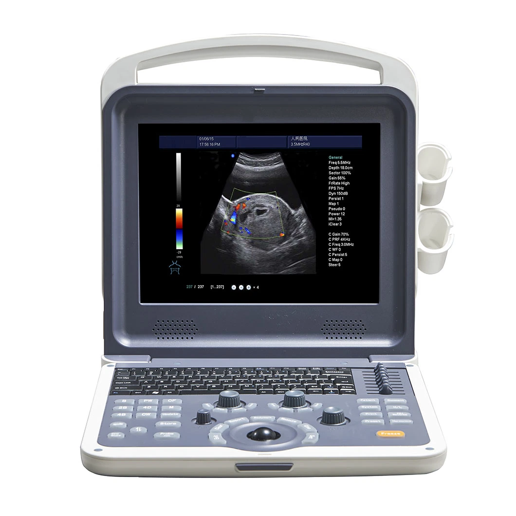 Medical Diagnostic Equipment Portable Digital Color Doppler 4D Ultrasound Scanner