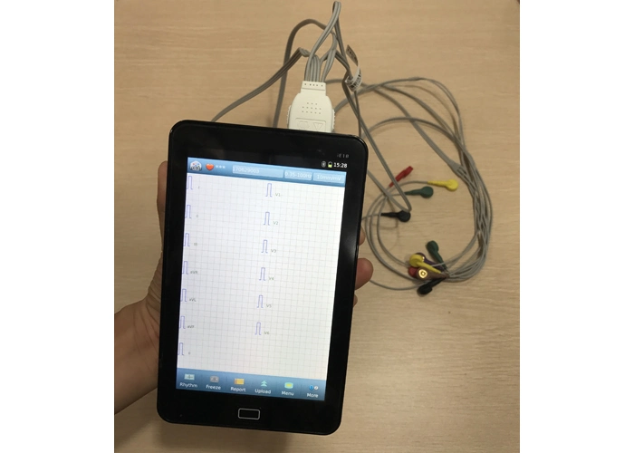 12 Channel 12 Lead Mobile ECG Monitor with 7 Inch LCD Touch Screen