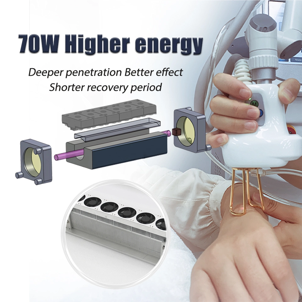 Vaginal Tightening Machine Acne Scar Stretch Mark Removal Fractional CO2 Laser Machine