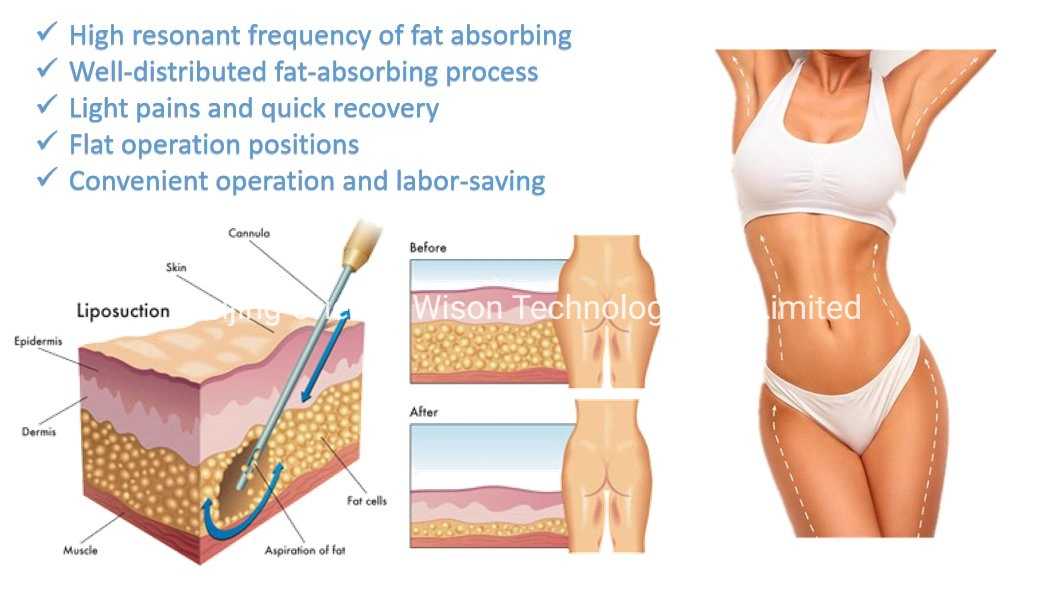 PAL Fat Reduce Liposuction Body Slimming Lipo Suction Plastic Surgical Machine / Weight Loss PAL Liposuction Cellulite Removal