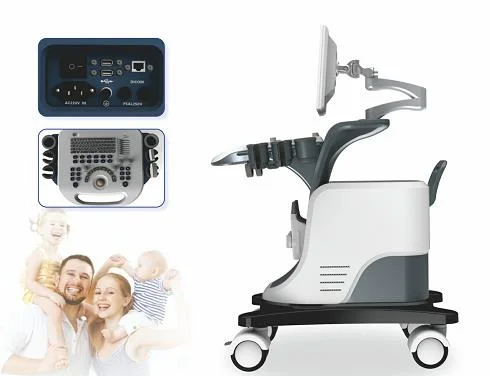 Xf7500 Trolley Color Doppler Ultrasound Scanner for Cat