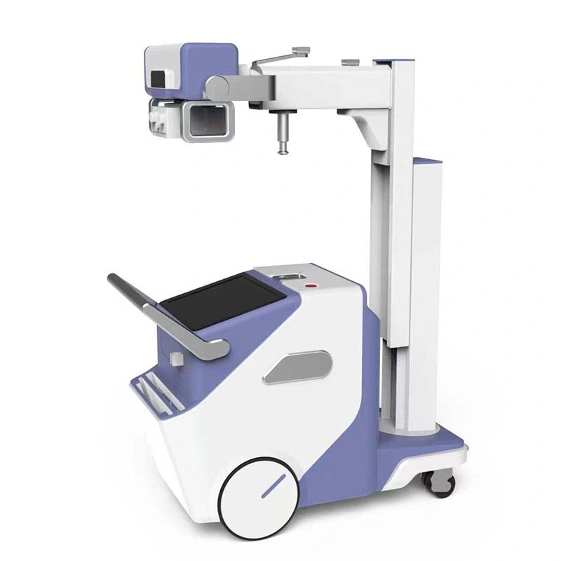 32kw a 50kw de radiografía digital móvil de la máquina de rayos X.
