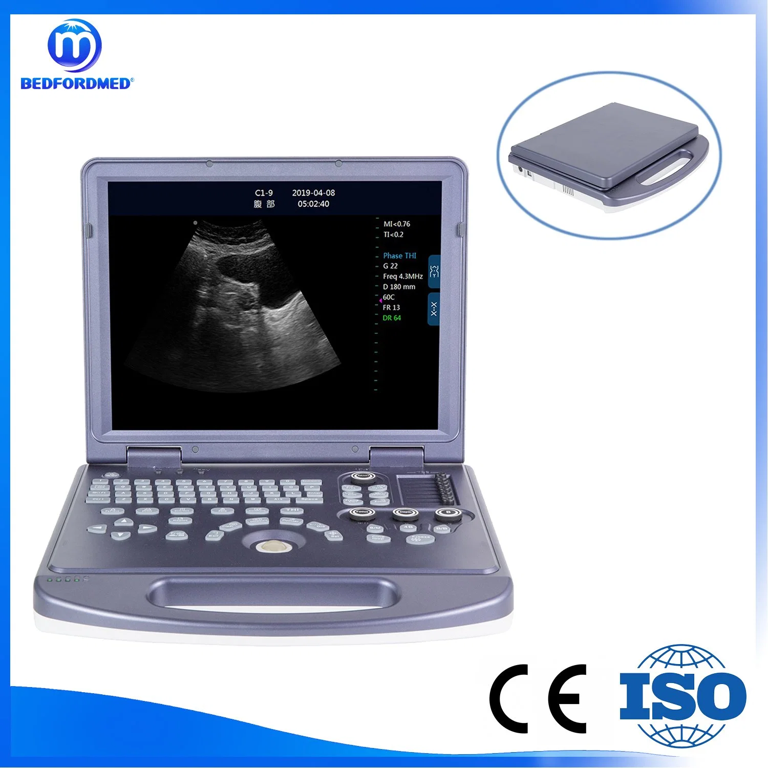 Medical Products High-Performance Color Ultrasound Equipment Me-360 M32PC