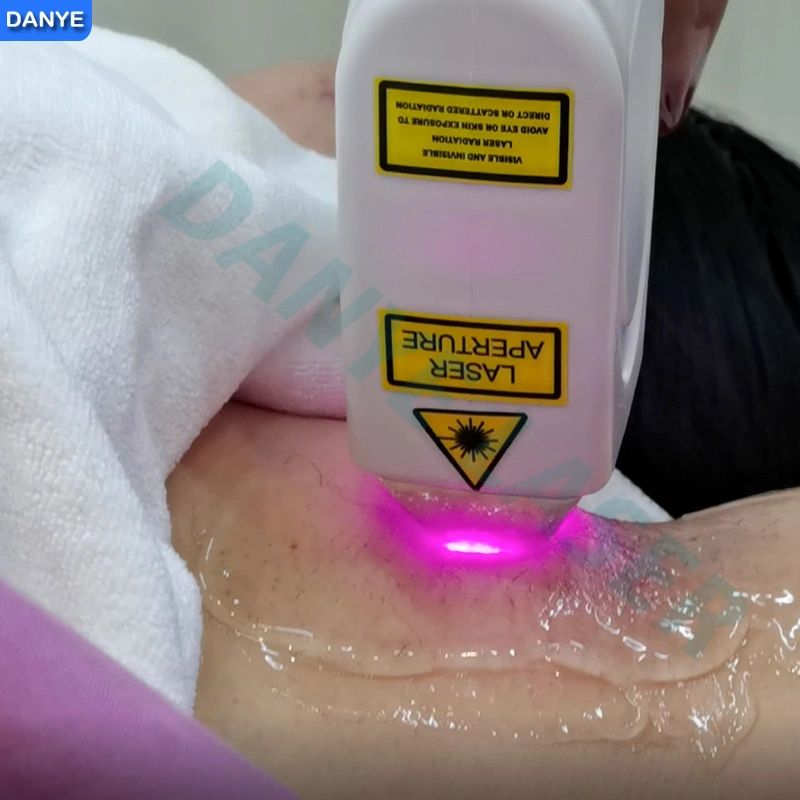 Diode Laser Portable glace 808 Lser Enlèvement de cheveux Salon de l'équipement