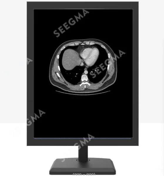 Top Quality Diagnostic 3MP Grayscale Medical Monitor with 3c