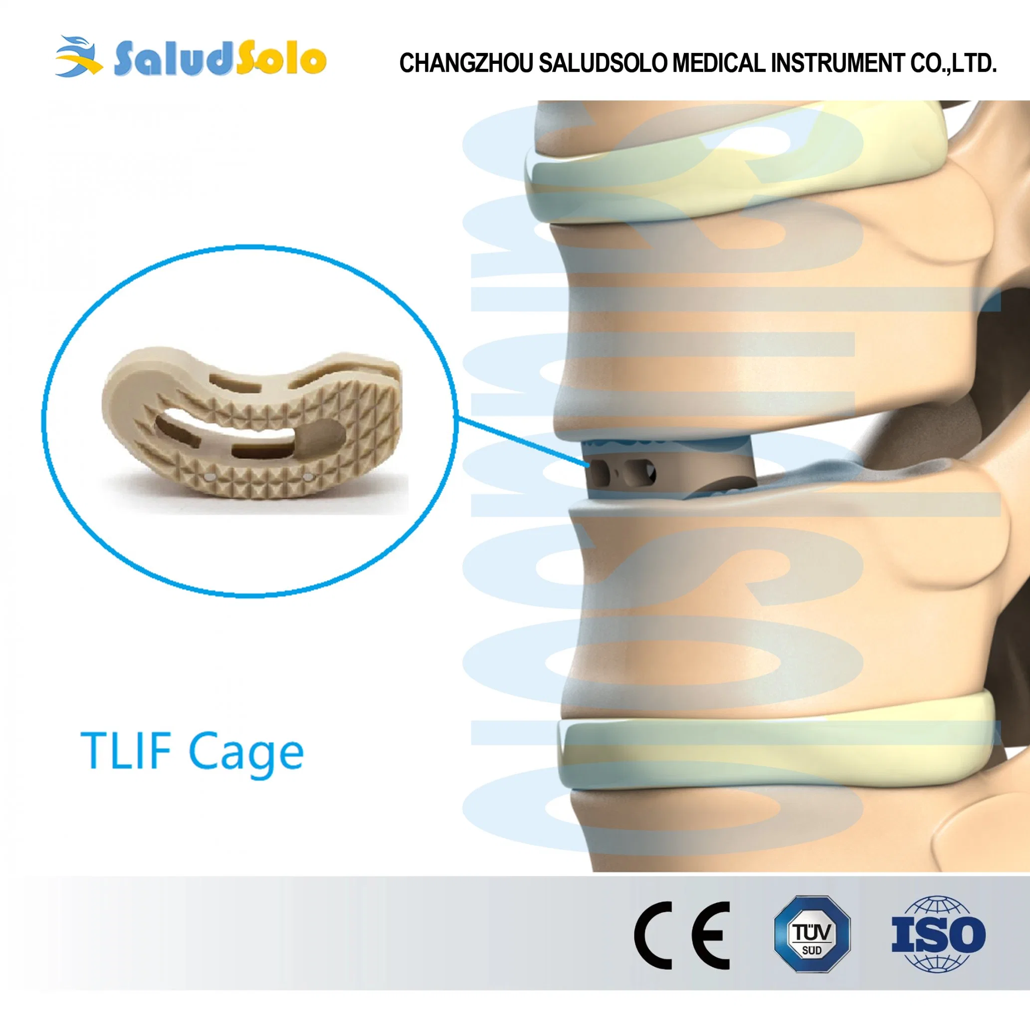 Transforaminal Lumbar Intervertebral Fusion (TLIF) Cage System, Peek Orthopedic Implant for Spine Surgery, CE&ISO Certified