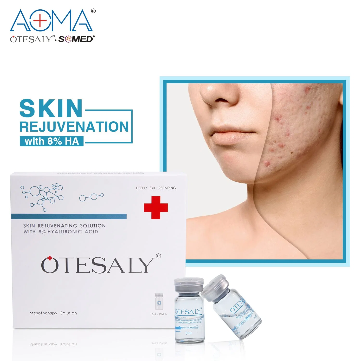 Otesaly Revitalization Injection Racemic Glutathione Product Skin Rejuvenation Solution Used to Reduce Skin Pigmentation 5ml Bottle