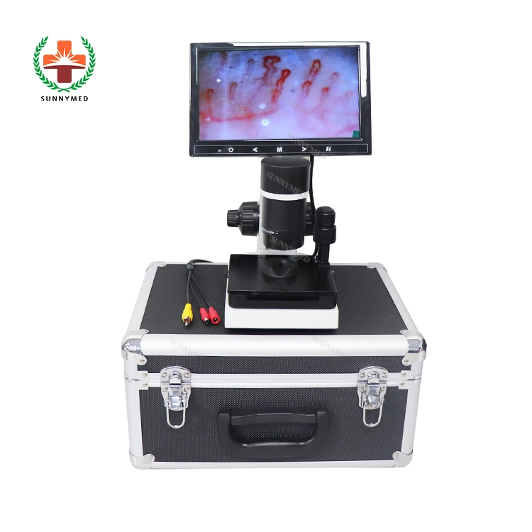 Micro Circulation Medical Hospital Machine Capillary Microscope