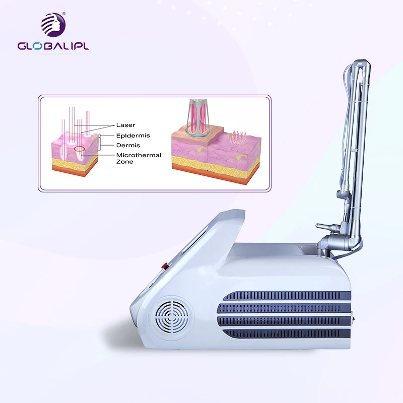 Más Caliente de 2020 el CO2 láser fraccional de RF de eliminación de arrugas radiofrecuencia fraccionada Micro-Needle