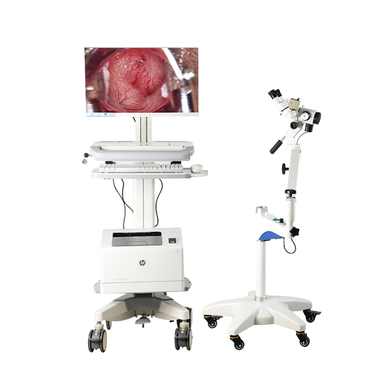 Gynecological Colposcopy Machine Equipment Set with Camera