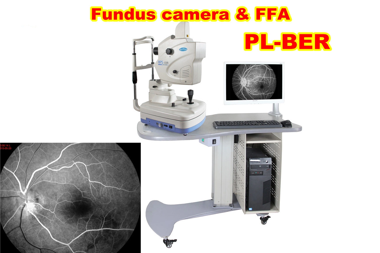 Manufacturing Fundus Camera & Ffa China Ophthalmic Medical