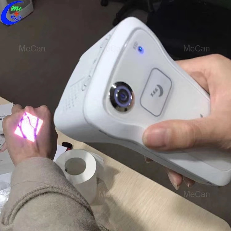 Acquires Image of Subcutaneous Veins Handheld Portable Infrared Vein Finder