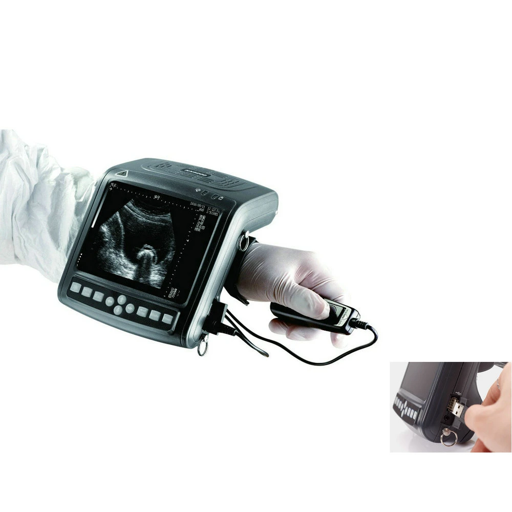 Large Animal Handheld All-Digital Type B Portable Veterinary Ultrasound Machine