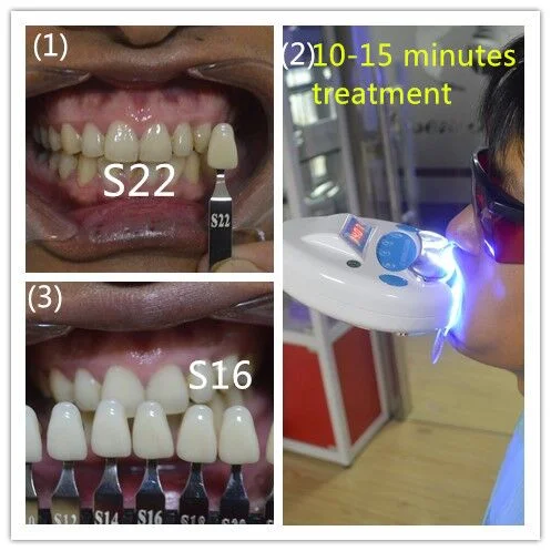 Lampe LED numérique dentaires Blanchiment des dents la lumière de la machine laser