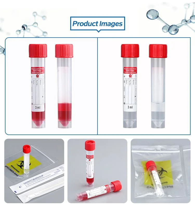 Discount Today Low Price Factory Supply Vtm Kit Virus Sampling Tube with Swab for CE Quality