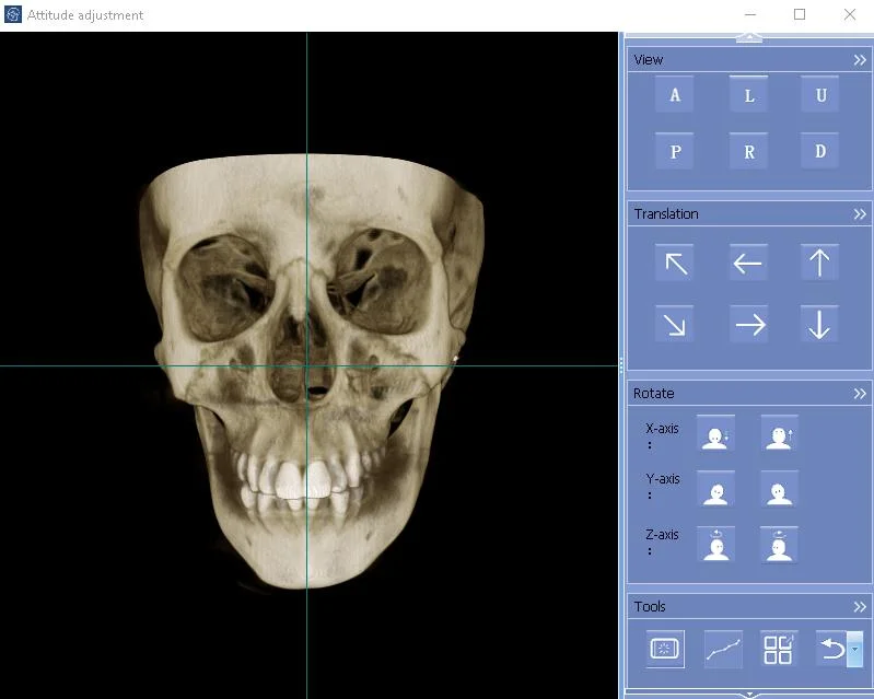 Hires 3D Dental CBCT Implant Inspection Equipment Implant Simulation TMJ Bild Neue Cbct-Kopffüßlersitzbank
