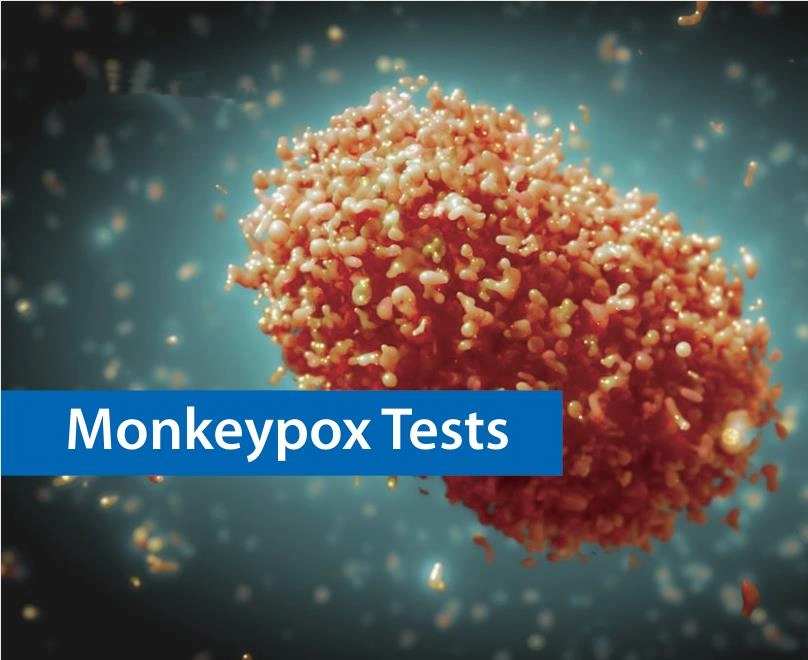 CE Быстрый испытательный комплект для быстрой проверки Monkeypox Monkeypox