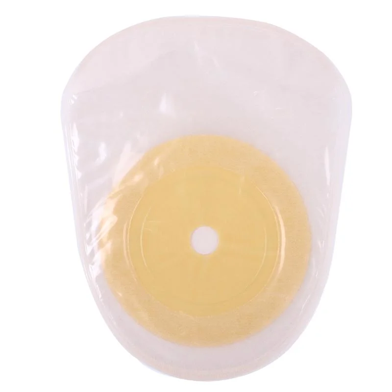 Medical Hospitals and Clinics Using Disposable One-Piece Closed Pouch Hydrocolloid Colostomy Bag