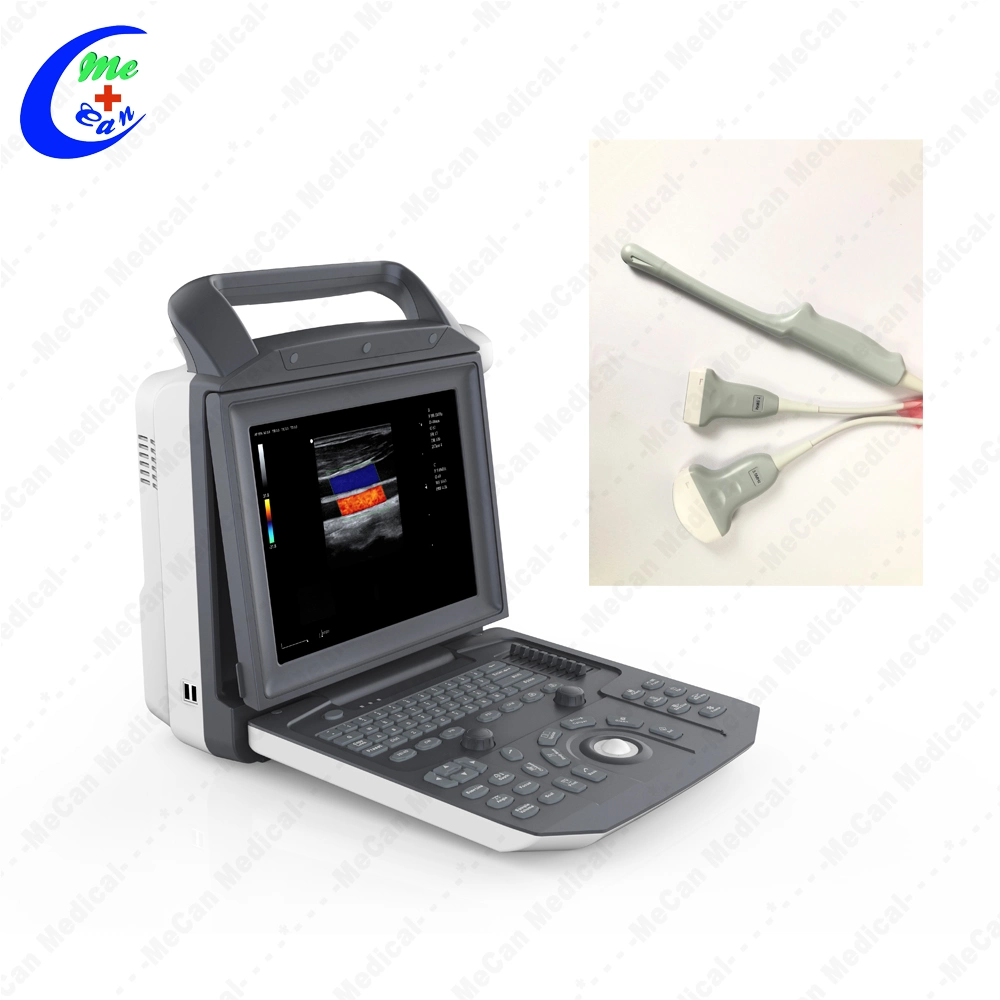 Medical ultrasonidos en 3D portátil Doppler Color Ecógrafo