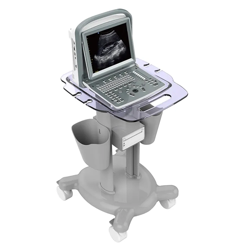 Chison Eco1 Ultrasound Machine with CE Portable Ultrasound Scanner